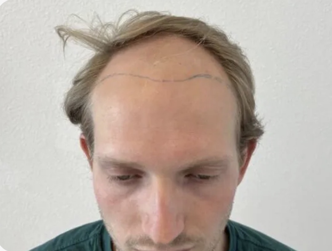 Voor